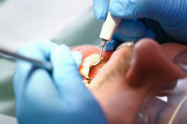 Best Emergency Treatment for Dental Infections or Abscesses in Mystic Island, NJ